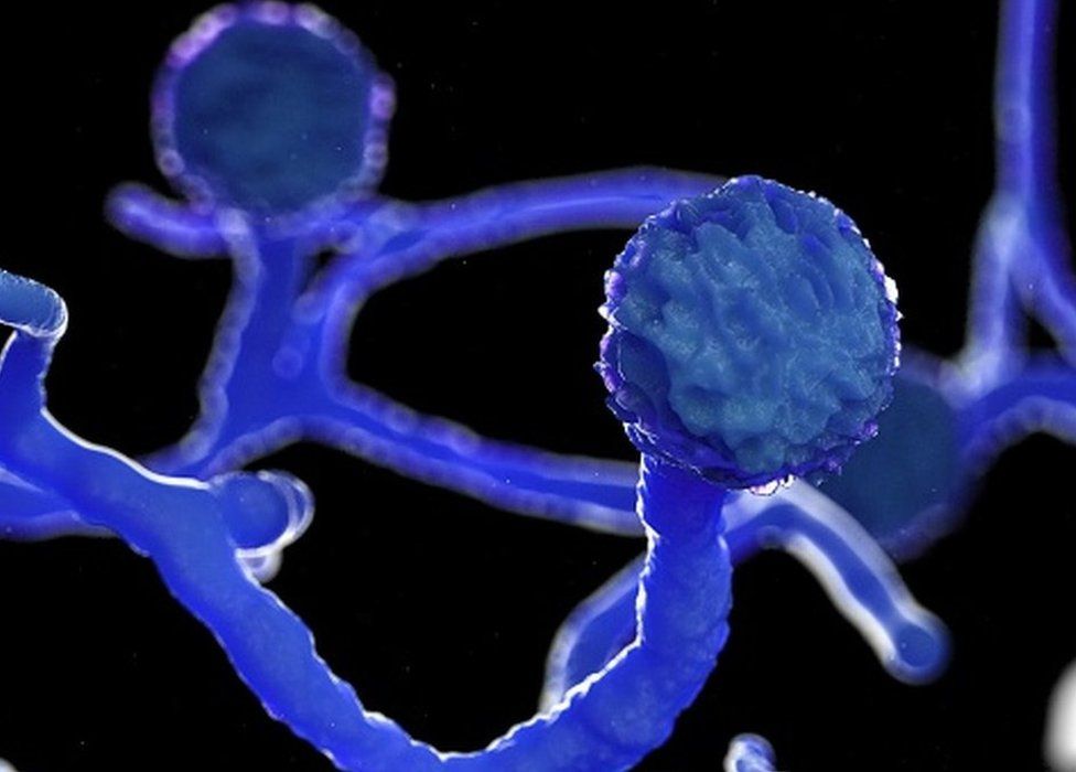 अनियंत्रित डायबिटीज और स्टेरायड के अत्यधिक उपयोग से ब्लैक  फंगस (म्युकरमाइकोसिस)  की संभावना अधिक 76 प्रकरण हैं अभी राज्य में                सभी का इलाज जारी