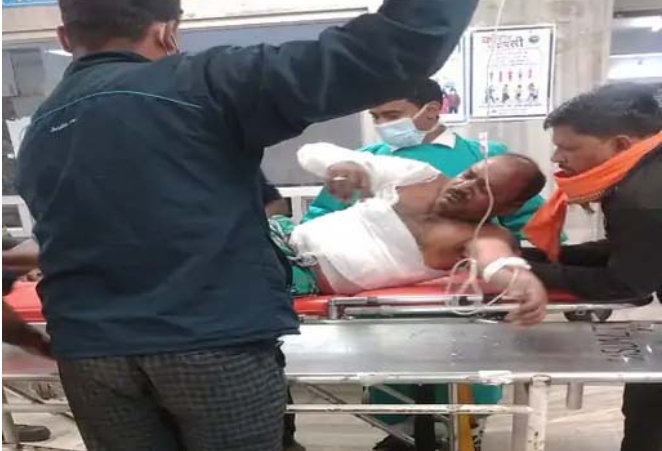 एक बार फिर बड़ा हादसा स्लैग में गर्म पानी डालते समय भिलाई स्टील प्लांट में विस्फोट, 6 मजदूर झुलसे, 5 अस्पताल में भर्ती, क्रेन ऑपरेटर गंभीर