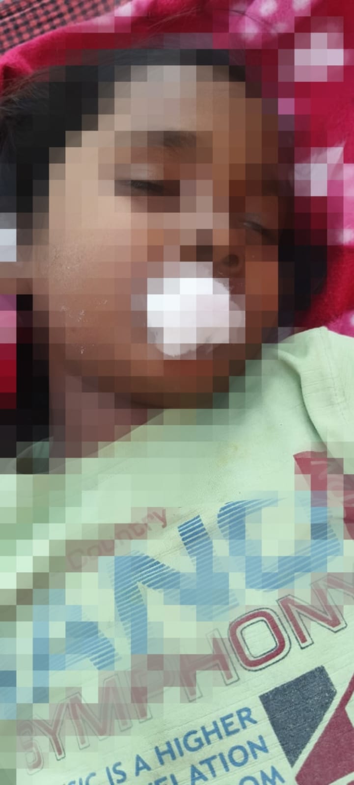 जामुन तोड़ते वक्त सात साल की बच्ची को बिच्छू ने मारा डंक दर्दनाक मौत