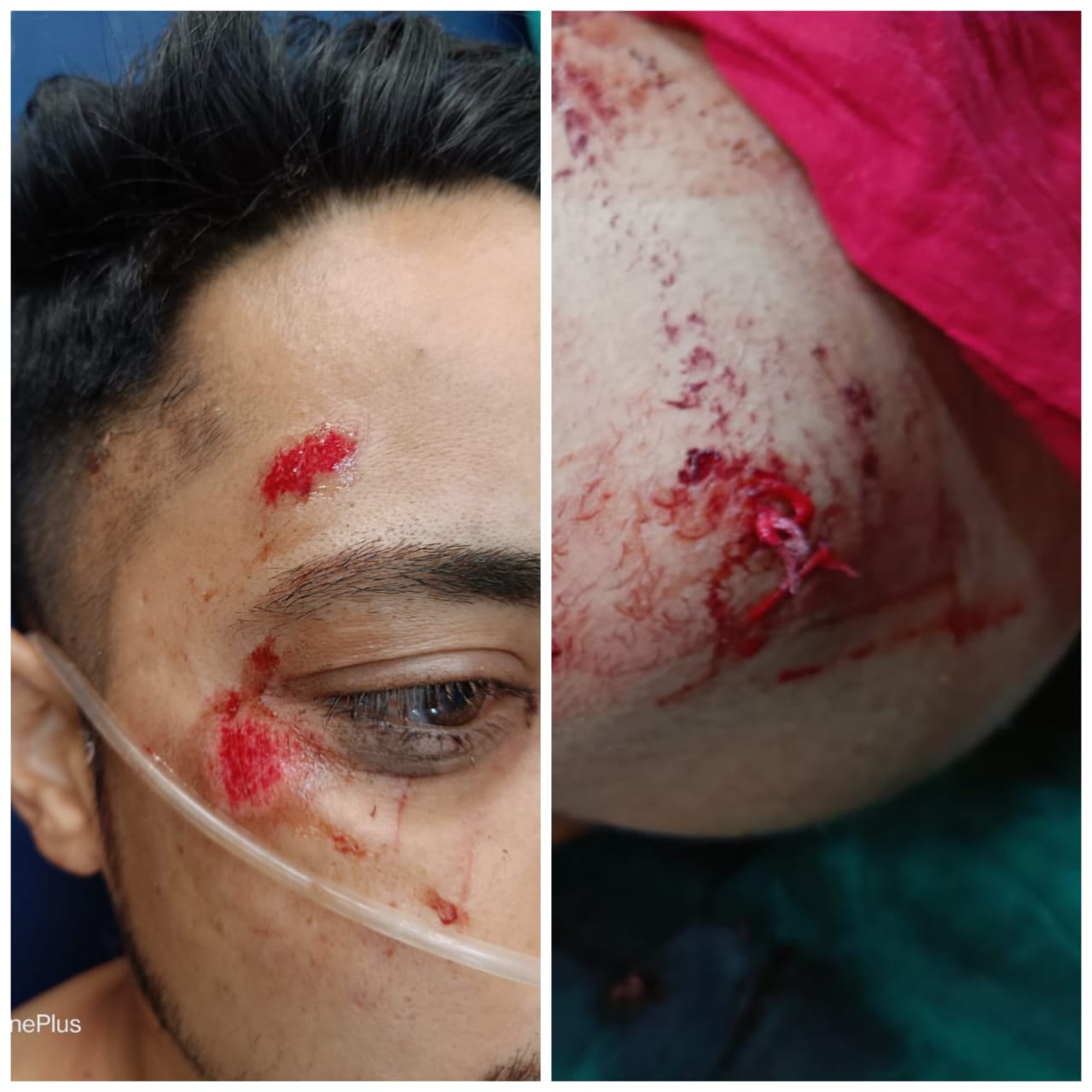 सिमगा थाना क्षेत्र में हुई चाकु बाजी...चाकु बाजी मे एक युवक की हालत गंभीर...