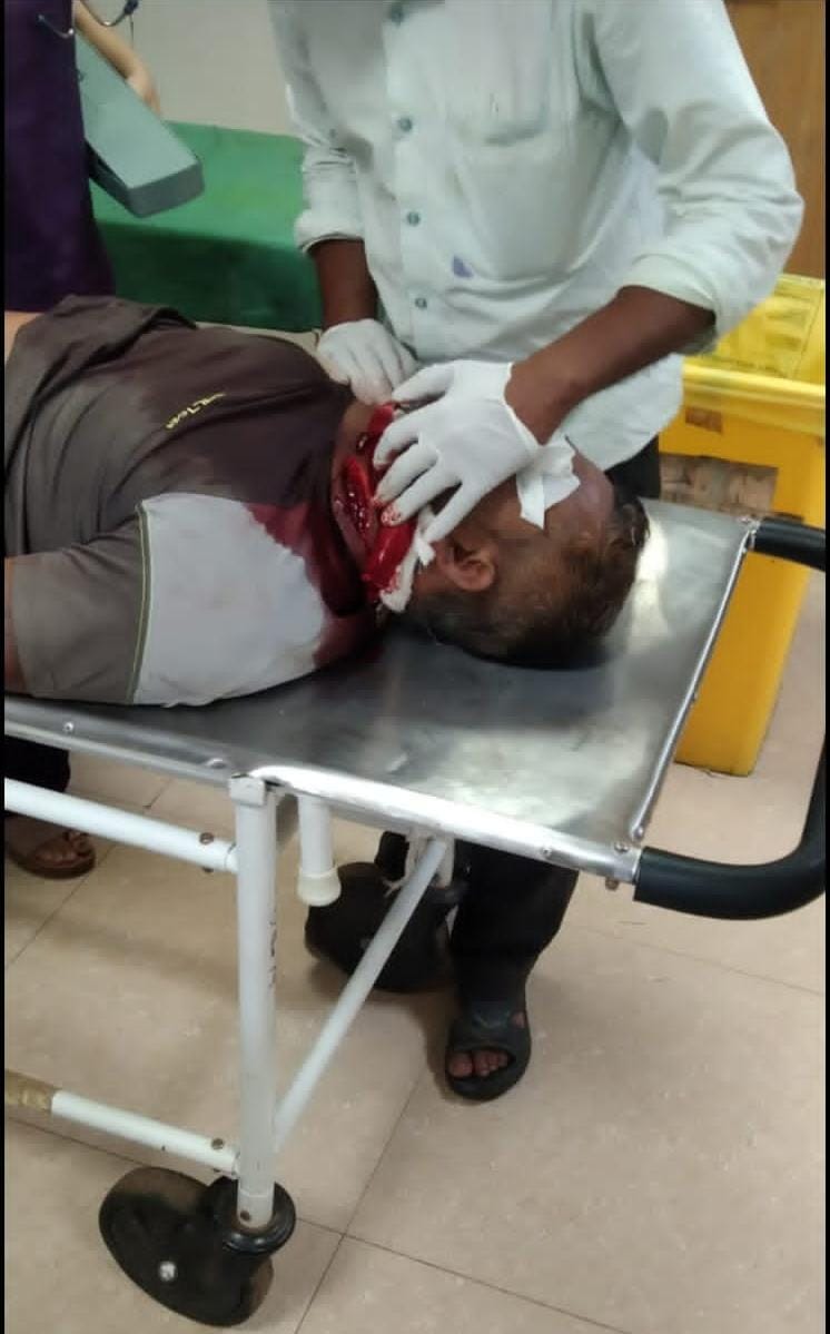 छत्तीसगढ़ गौ सेवा आयोग के उपाध्यक्ष के भतीजे पर जानलेवा हमला