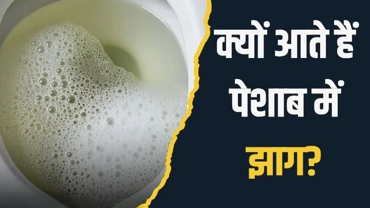 पेशाब में झाग आने का क्या मतलब होता है? आयुर्वेदिक न्यूट्रिशनिस्ट नेˈ बताया क्या करें और कैसे दूर होगी दिक्कत